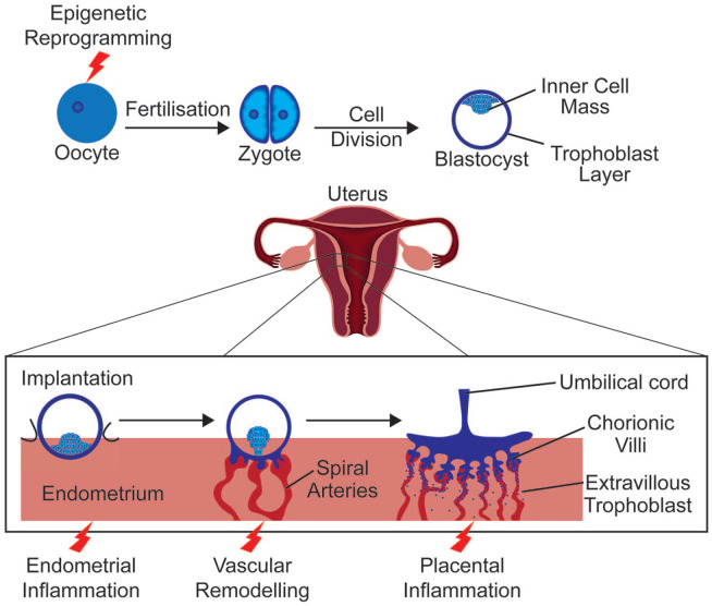 Maternal obesity and developmental programming of neuropsychiatric disorders: An inflammatory hypothesis.