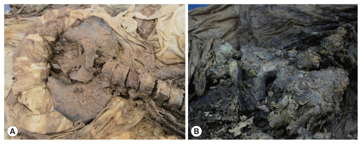 Two Helminthic Cases of Human Mummy Remains from Joseon-Period Graves in Korea.