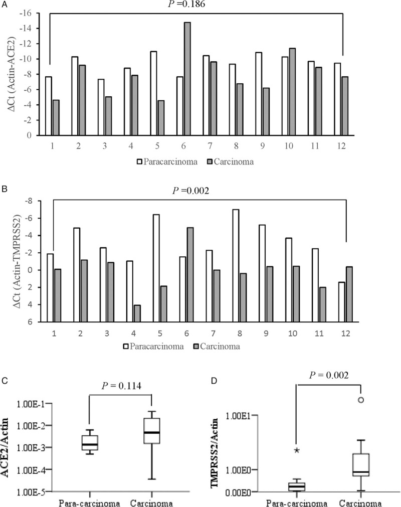 ACE2 and TMPRSS2 Expression in Hepatocytes of Chronic HBV Infection Patients.