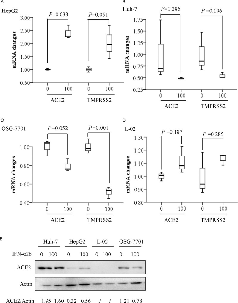 ACE2 and TMPRSS2 Expression in Hepatocytes of Chronic HBV Infection Patients.