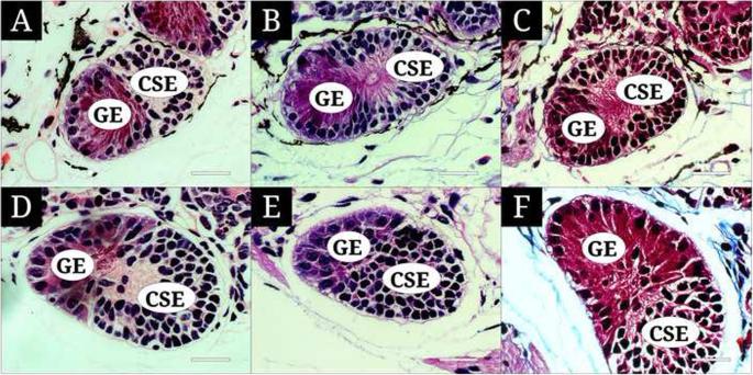 Morphology and histology of the olfactory organ of two African lungfishes, Protopterus amphibius and P. dolloi (Lepidosirenidae, Dipnoi)