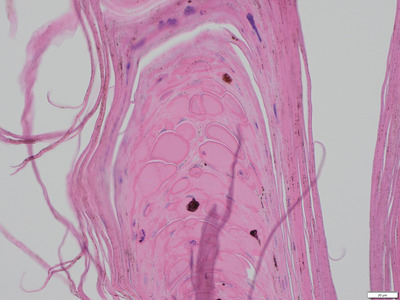 Nasal hyperkeratosis in Griffon breeds: Clinical, histopathological features and the prevalence in the Swedish population compared to a control group and other brachycephalic breeds.