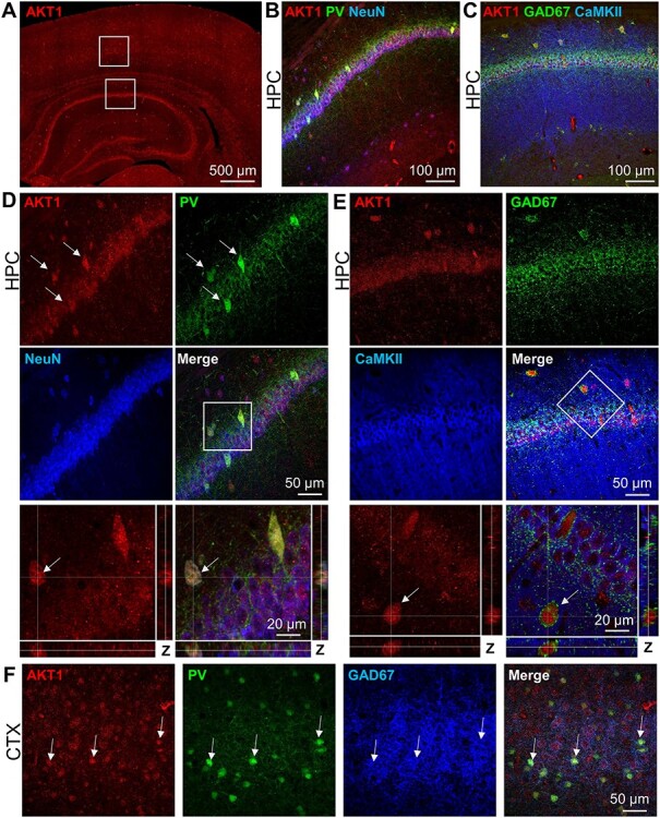 Immunohistological Examination of AKT Isoforms in the Brain: Cell-Type Specificity That May Underlie AKT's Role in Complex Brain Disorders and Neurological Disease.