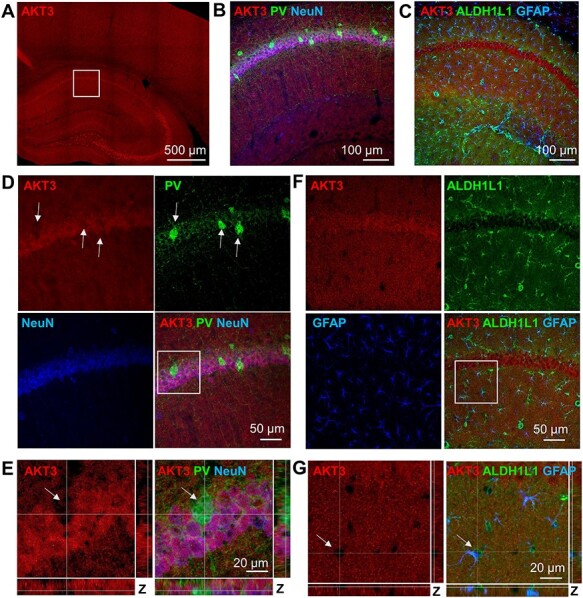 Immunohistological Examination of AKT Isoforms in the Brain: Cell-Type Specificity That May Underlie AKT's Role in Complex Brain Disorders and Neurological Disease.