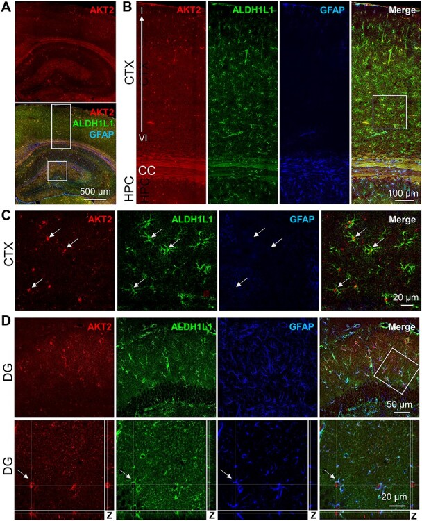 Immunohistological Examination of AKT Isoforms in the Brain: Cell-Type Specificity That May Underlie AKT's Role in Complex Brain Disorders and Neurological Disease.