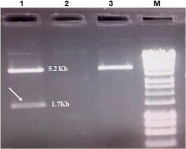 Immunocontraceptive potential of a GnRH receptor-based fusion recombinant protein.