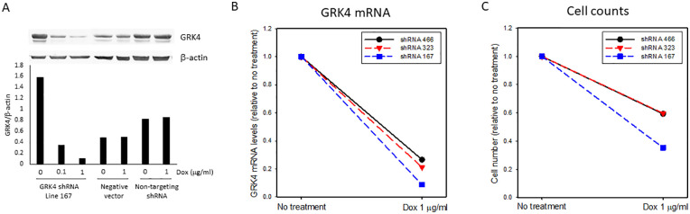 The Hypertension Related Gene G-Protein Coupled Receptor Kinase 4 Contributes to Breast Cancer Proliferation.