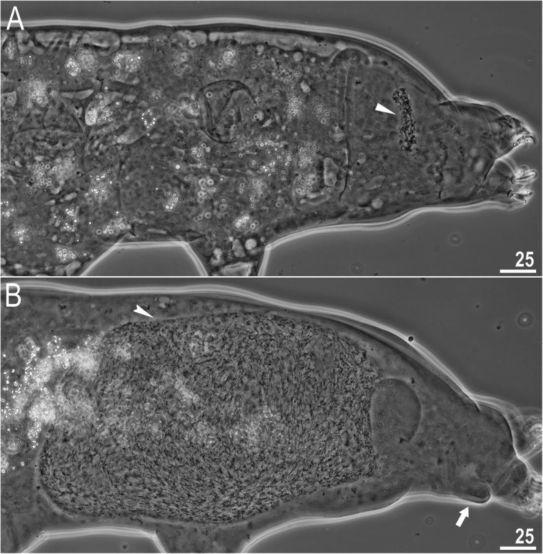 Integrative taxonomy resolves species identities within the Macrobiotus pallarii complex (Eutardigrada: Macrobiotidae).