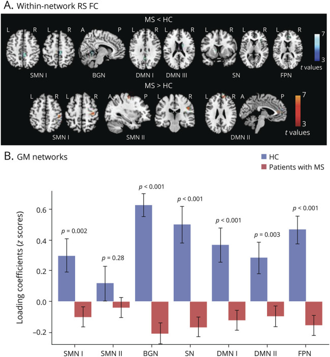Network Damage Predicts Clinical Worsening in Multiple Sclerosis: A 6.4-Year Study.