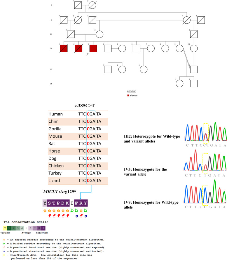 Identification of a novel MICU1 nonsense variant causes myopathy with extrapyramidal signs in an Iranian consanguineous family.