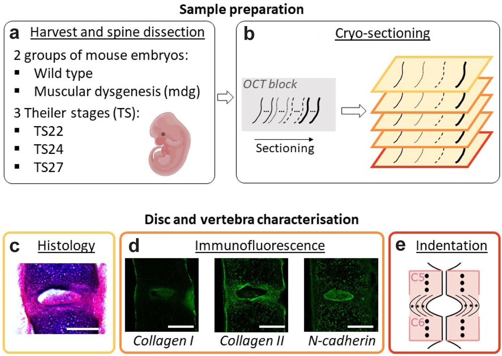 Prenatal muscle forces are necessary for vertebral segmentation and disc structure, but not for notochord involution in mice.