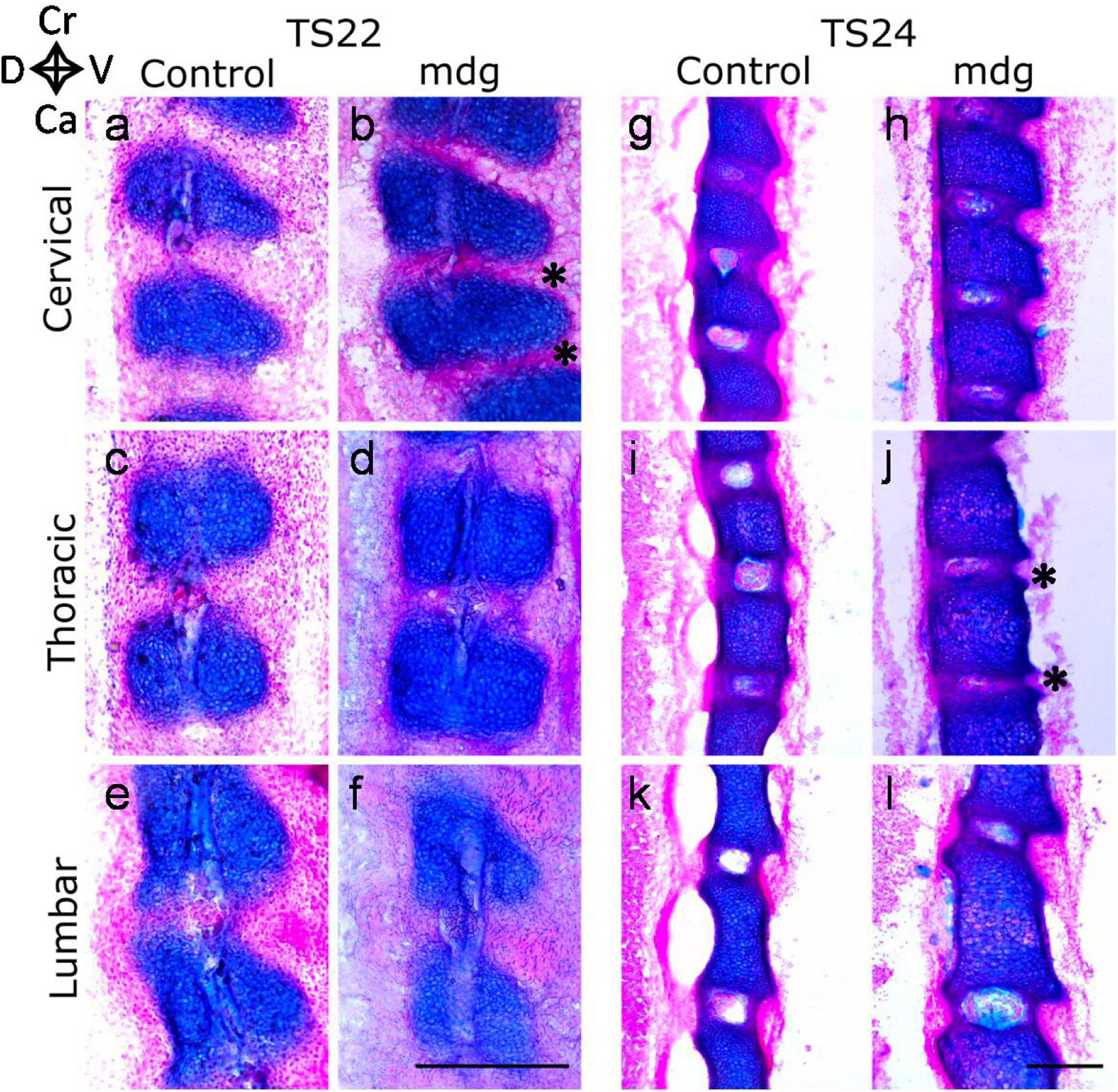 Prenatal muscle forces are necessary for vertebral segmentation and disc structure, but not for notochord involution in mice.