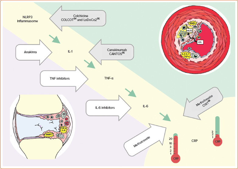 Atherosclerotic Cardiovascular Disease in Rheumatoid Arthritis: Impact of Inflammation and Antirheumatic Treatment.