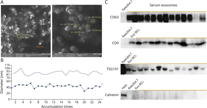 Exosomes From Subjects With Multiple Sclerosis Express EBV-Derived Proteins and Activate Monocyte-Derived Macrophages.