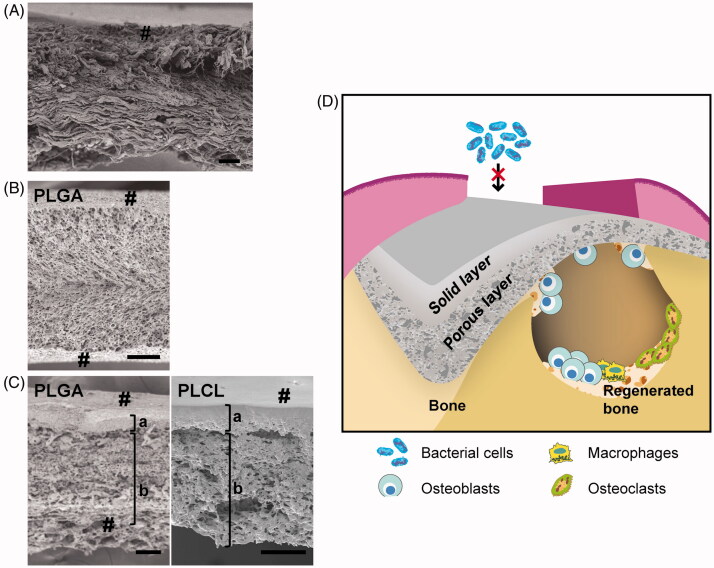 Barrier membranes for tissue regeneration in dentistry.