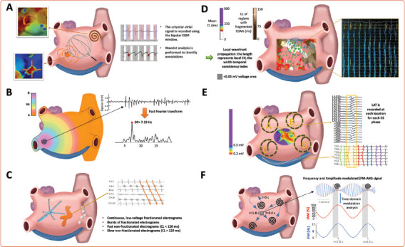 Mapping Technologies for Catheter Ablation of Atrial Fibrillation Beyond Pulmonary Vein Isolation.