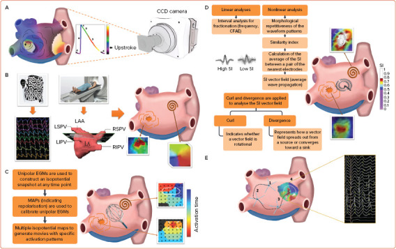 Mapping Technologies for Catheter Ablation of Atrial Fibrillation Beyond Pulmonary Vein Isolation.