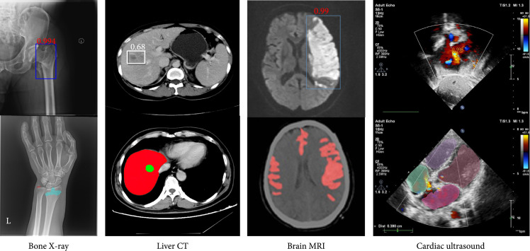 Advances in Deep Learning-Based Medical Image Analysis.