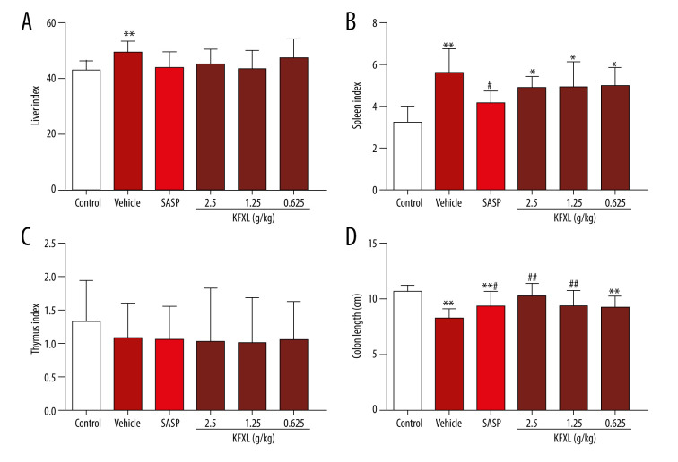 Kangfuxin Liquid Ameliorates Dextran Sulfate Sodium (DSS)-Induced Acute Ulcerative Colitis in Mice by Modulating Immune Response and Suppressing Inflammation.