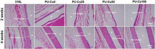 Copper-mediated polyurethane materials with enzyme-like catalysis for biocompatibility improvement in blood environments