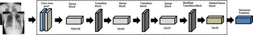 Deep convolution neural networks to differentiate between COVID-19 and other pulmonary abnormalities on chest radiographs: Evaluation using internal and external datasets