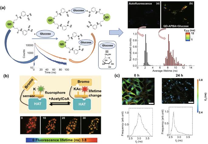 FLIM as a Promising Tool for Cancer Diagnosis and Treatment Monitoring