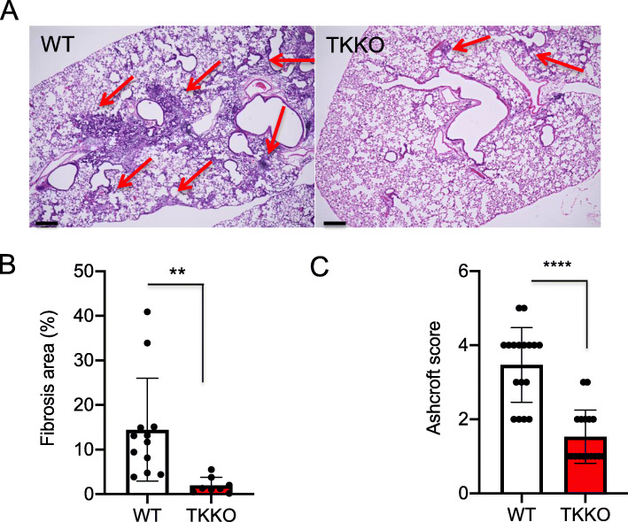 VEGFR1-tyrosine kinase signaling in pulmonary fibrosis.