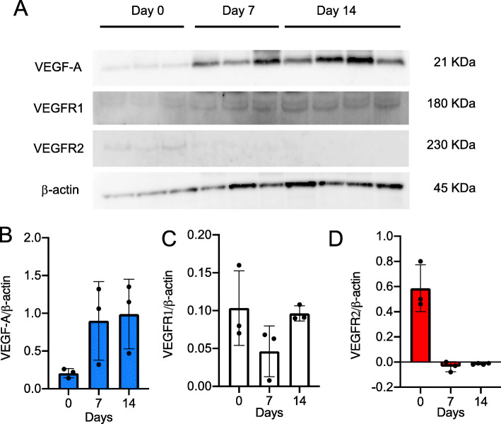 VEGFR1-tyrosine kinase signaling in pulmonary fibrosis.