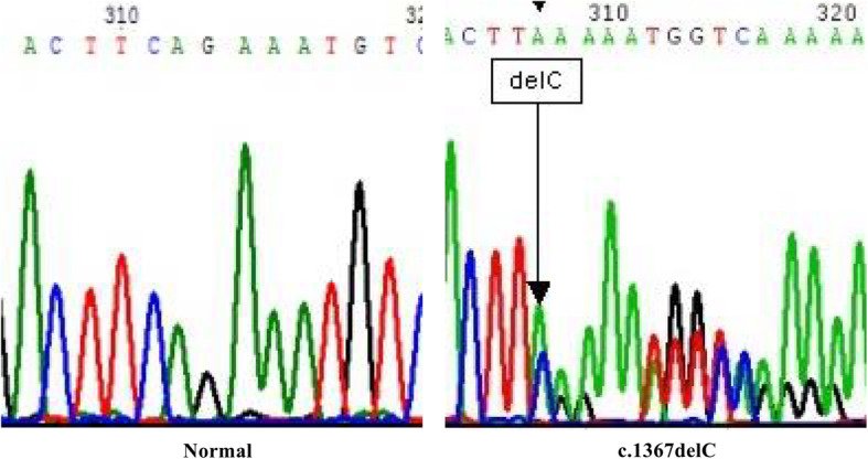 A novel germline mutation in hMLH1 in three Korean women with endometrial cancer in a family of Lynch syndrome: case report and literature review.