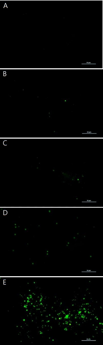 Fibrosis as a result of polyhexamethylene guanide exposure in cultured Statens Seruminstitut Rabbit Cornea (SIRC) cells.