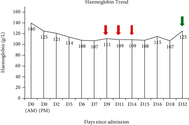 Use of Intrapleural Fibrinolytic Therapy in a Trapped Lung following Acute Traumatic Haemothorax.