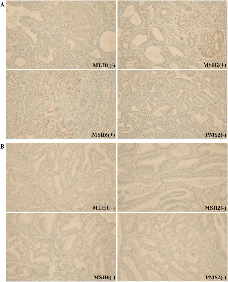 A novel germline mutation in hMLH1 in three Korean women with endometrial cancer in a family of Lynch syndrome: case report and literature review.