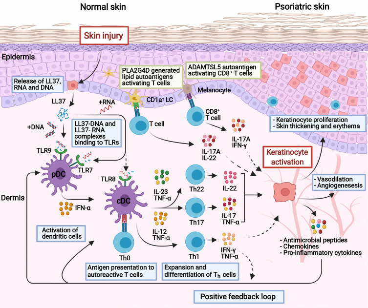 Key Signaling Pathways in Psoriasis: Recent Insights from Antipsoriatic Therapeutics.