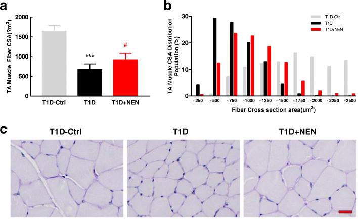 Niclosamide ethanolamine ameliorates diabetes-related muscle wasting by inhibiting autophagy.