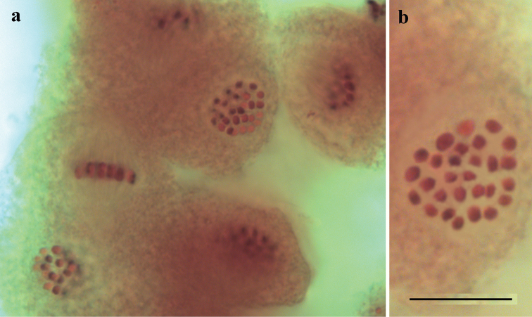 Chromosomal and DNA barcode analysis of the <i>Melitaea ala</i> Staudinger, 1881 species complex (Lepidoptera, Nymphalidae).