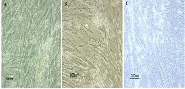 In vitro osteogenic induction of human adipose stem cells co-treated with betaine/osteogenesis differentiation medium.