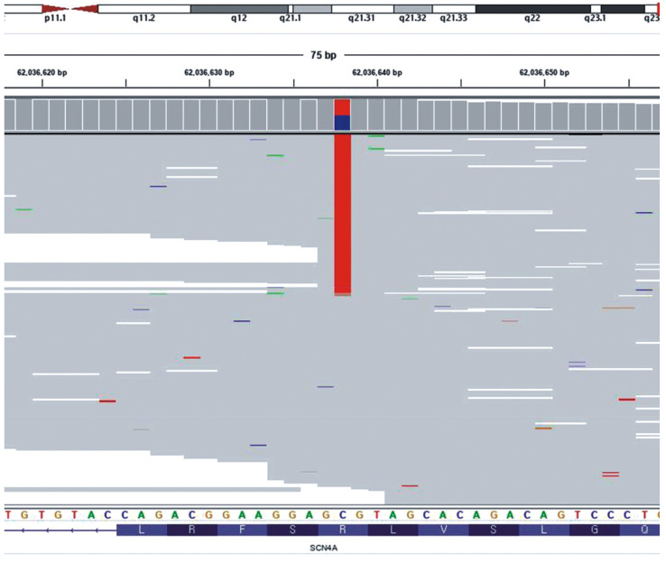 Confirming Genetic Abnormalities of Hypokalemic Periodic Paralysis Using Next-Generation Sequencing: A Case Report and Literature Review.