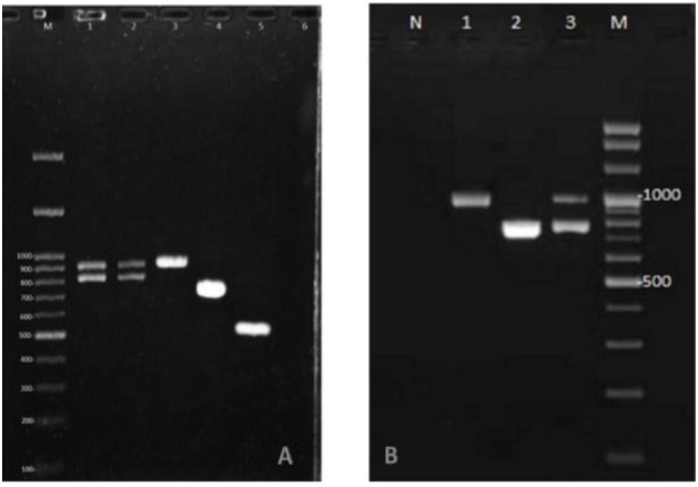 Differentiation of <i>Candida albicans</i> complex species isolated from invasive and non-invasive infections using <i>HWP1</i> gene size polymorphism.