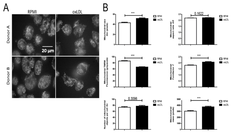 oxLDL-Induced Trained Immunity Is Dependent on Mitochondrial Metabolic Reprogramming.