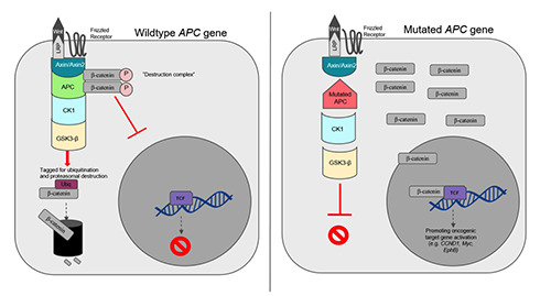 <i>Adenomatous polyposis</i> coli in cancer and therapeutic implications.