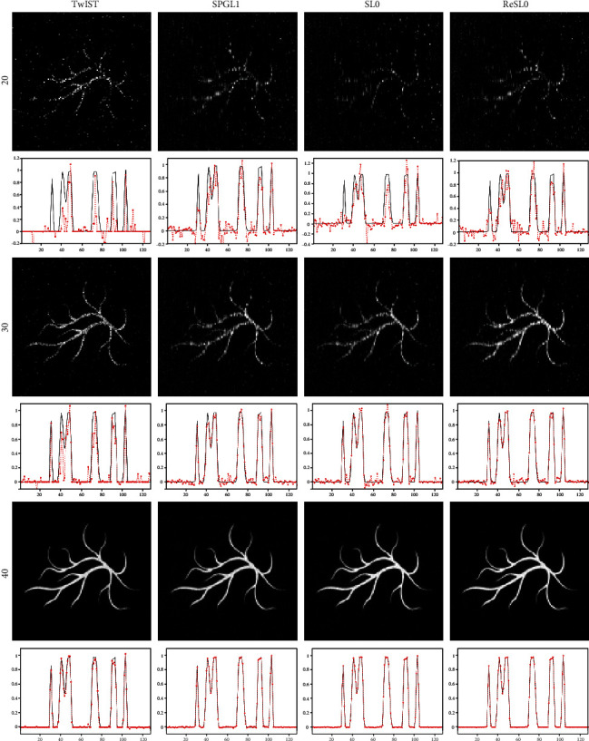 A Photoacoustic Imaging Algorithm Based on Regularized Smoothed L<sub>0</sub> Norm Minimization.