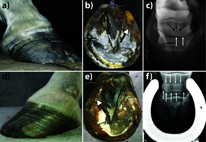 Modified Z-bar shoe eliminates occasional frog bruising accompanying Z-bar shoeing for navicular syndrome management in underrun-heeled horses.