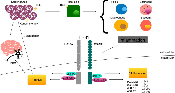 IL-31, itch and hematological malignancies.