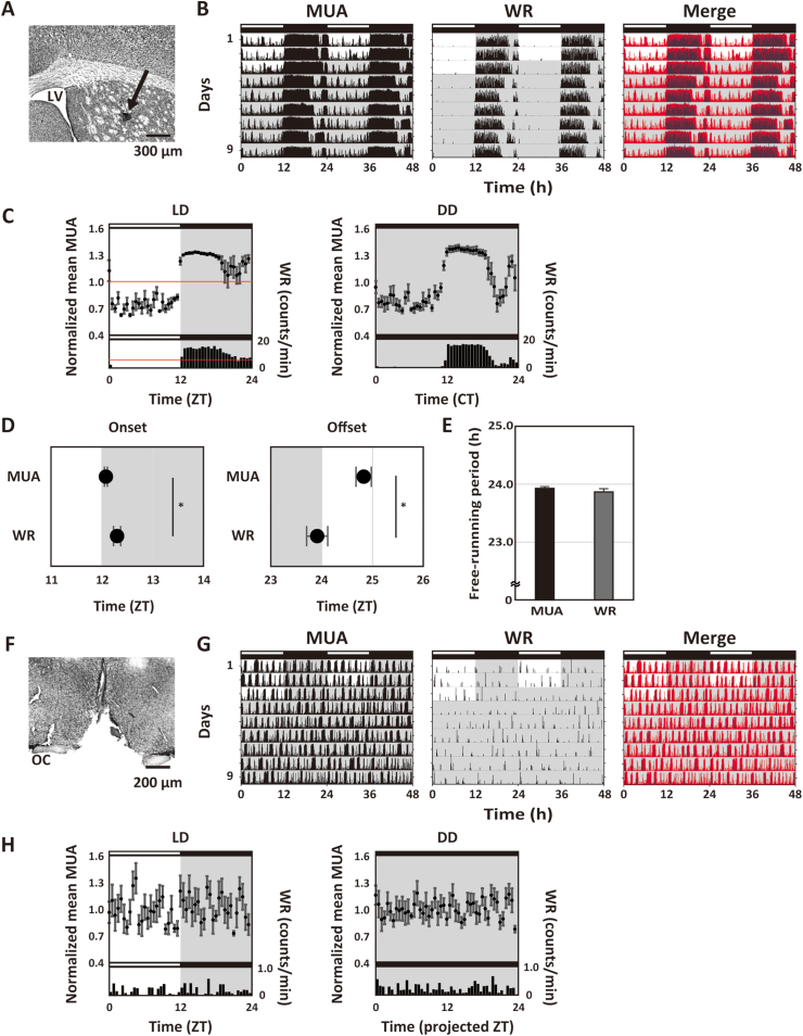 Chronic methamphetamine uncovers a circadian rhythm in multiple-unit neural activity in the dorsal striatum which is independent of the suprachiasmatic nucleus