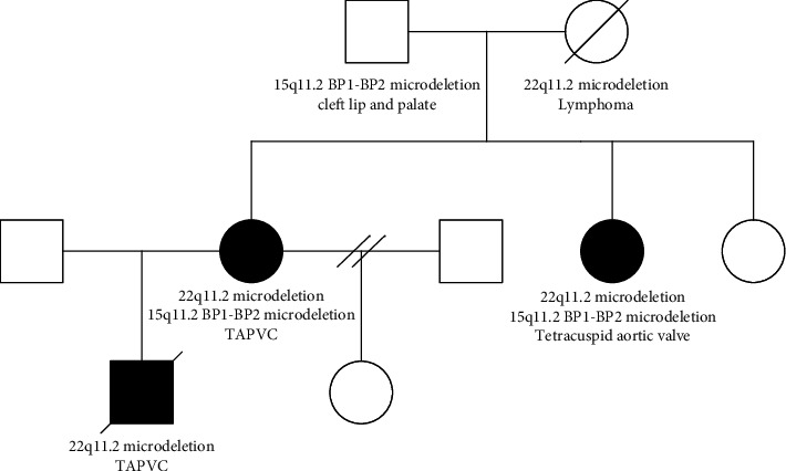 Total Anomalous Pulmonary Venous Connection in Mother and Son with a Central 22q11.2 Microdeletion.