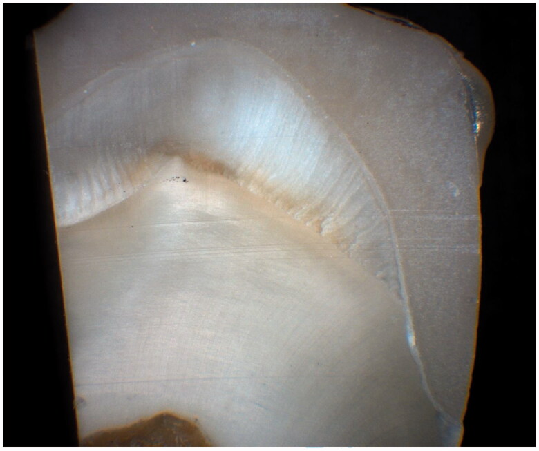 Marginal and internal fit of crowns based on additive or subtractive manufacturing.