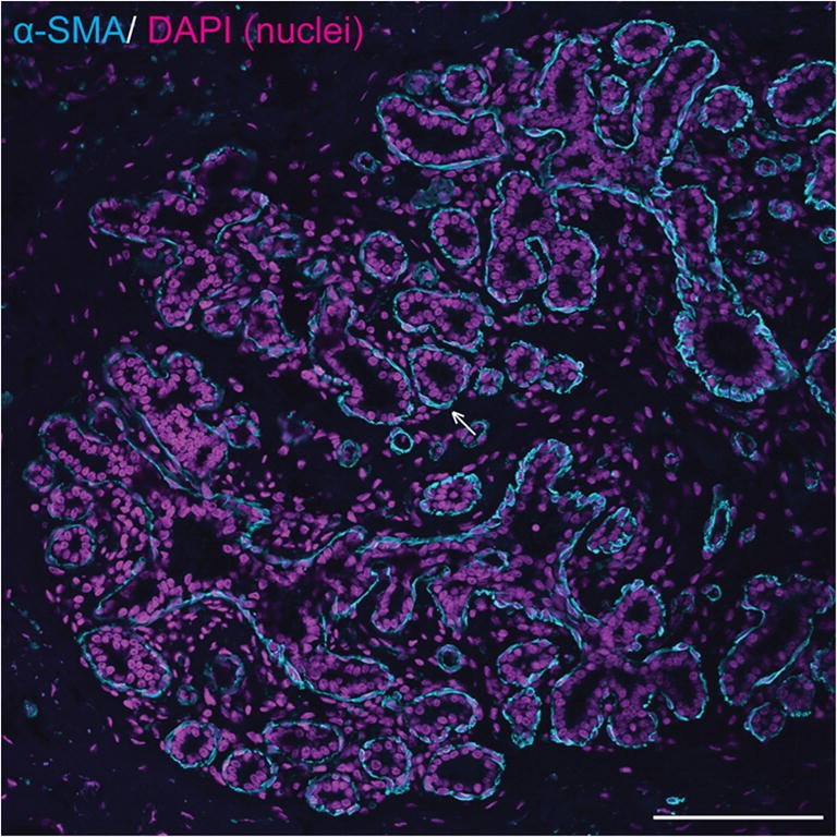 Development and Pathology of the Equine Mammary Gland.