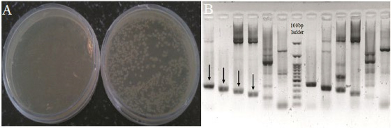 Experimental validation of a predicted microRNA within human <i>FVIII</i> gene.