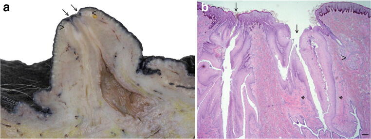 Development and Pathology of the Equine Mammary Gland.