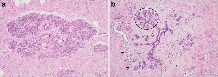 Development and Pathology of the Equine Mammary Gland.